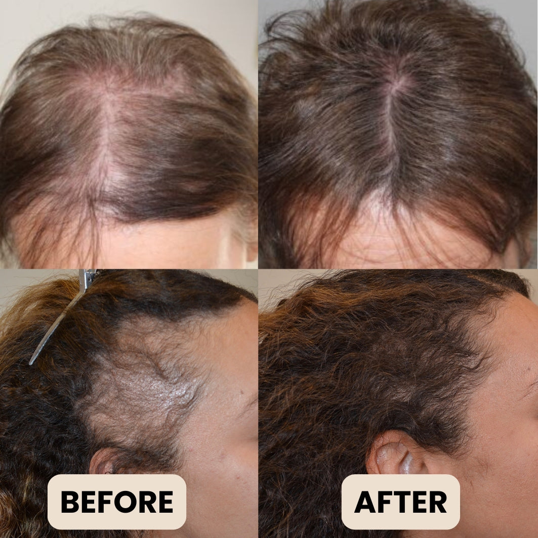 Batana Pure® : Growth Booster